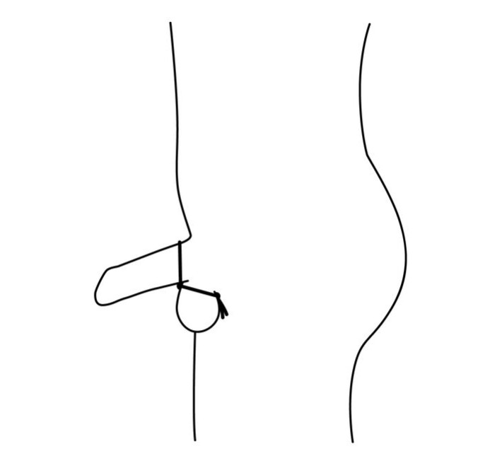 Подвійне ерекційне кільце-ласо Nexus FORGE, діаметр регулюється