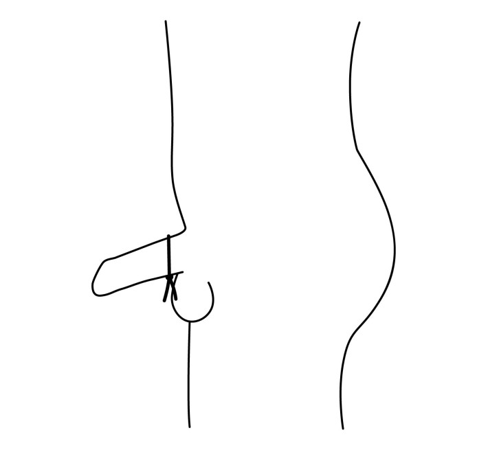 Ерекційне кільце-ласо Nexus FORGE, діаметр регулюється