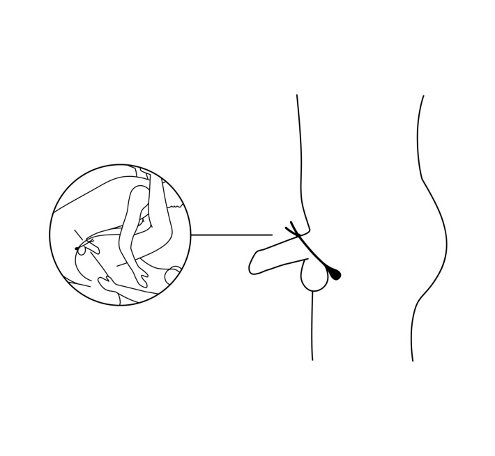 Ерекційне віброкільце-ласо Nexus FORGE Vibrating, 6 режимів